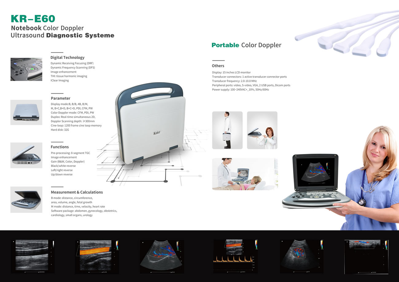 KR-E60便攜式彩超機(jī)